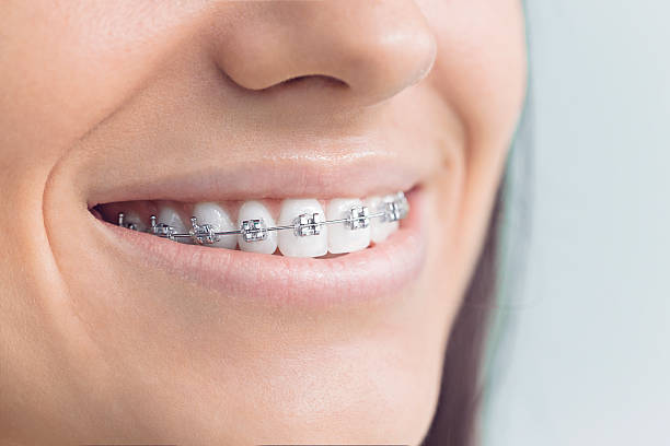 Dental Inlays and Onlays in Greenfield, MN